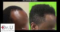 Dr U Hair & Skin Clinic image 7